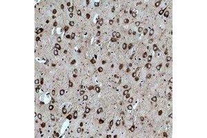 Immunohistochemical analysis of CACNG3 staining in rat brain formalin fixed paraffin embedded tissue section. (CACNG3 anticorps)