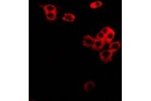 Immunofluorescent analysis of CD86 staining in MCF7 cells.