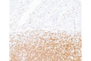 Immunohistochemistry (IHC) image for anti-CD247 Molecule (CD247) (C-Term) antibody (ABIN7455240)