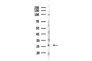 anti-Cysteine-Rich Secretory Protein 2 (CRISP2) (Internal Region) antibody