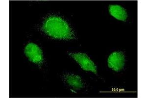 Image no. 1 for anti-alpha 1 Microglobulin/bikunin precursor (AMBP) (AA 19-353) antibody (ABIN598537) (AMBP anticorps  (AA 19-353))