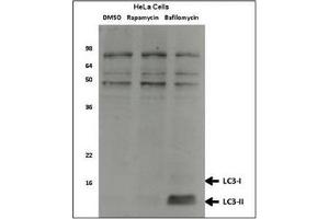 Western Blotting (WB) image for anti-Microtubule-Associated Protein 1 Light Chain 3 alpha (MAP1LC3A) antibody (ABIN5551132)