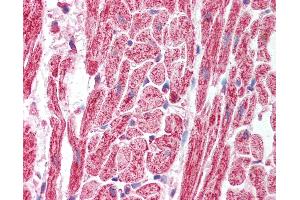 Anti-SAP18 antibody IHC of human heart.