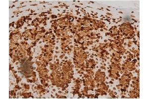 ABIN6256714 and ABIN6267384 at 1/200 staining Rat ganstric tissue sections by IHC-P.