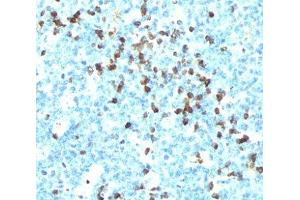 IHC testing of tonsil stained with Lambda light chain antibody (LcN-2).