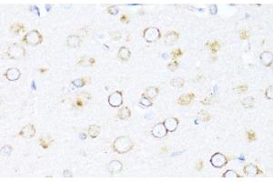 Immunohistochemistry of paraffin-embedded Rat brain using DNAJB11 Polyclonal Antibody at dilution of 1:100 (40x lens). (DNAJB11 anticorps)