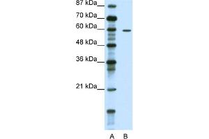 WB Suggested Anti-TRIM62 Antibody Titration:  1. (TRIM62 anticorps  (N-Term))