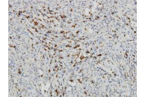 Immunoperoxidase of monoclonal antibody to IDO1 on formalin-fixed paraffin-embedded human spleen.
