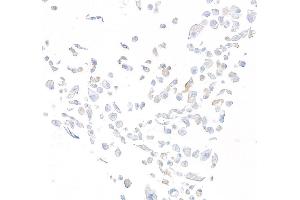Immunocytochemistry (ICC) image for anti-Dipeptidyl-Peptidase 4 (DPP4) (AA 29-766) antibody (ABIN7795691) (Recombinant DPP4 anticorps  (AA 29-766))