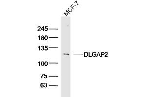 MCF-7 lysates probed with DLGAP2 Polyclonal Antibody, Unconjugated  at 1:300 dilution and 4˚C overnight incubation. (DLGAP2 anticorps  (AA 251-360))