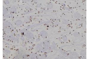 ABIN6266276 and ABIN6277441 at 1/100 staining Rat brain tissue by IHC-P.