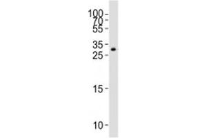 Western blot analysis of lysate from HT-1080 cell line using GDF15 antibody (GDF15 anticorps  (C-Term))
