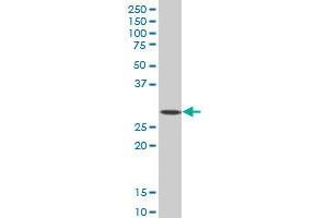 SIX3 monoclonal antibody (M10), clone 4H6.