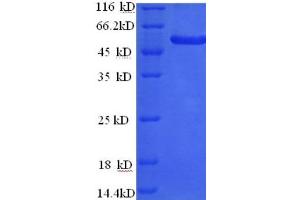 SDS-PAGE (SDS) image for PR Domain Containing 16 (PRDM16) (AA 19-471) protein (His tag) (ABIN5714164)