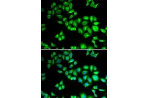 Immunofluorescence analysis of HeLa cells using CUL1 antibody. (Cullin 1 anticorps)