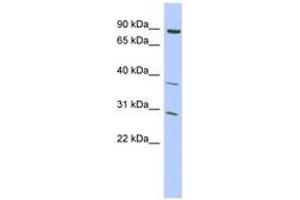 Image no. 1 for anti-Kelch-Like 5 (KLHL5) (C-Term) antibody (ABIN6742832) (KLHL5 anticorps  (C-Term))