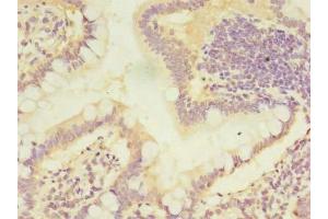 Immunohistochemistry of paraffin-embedded human small intestine tissue using ABIN7146755 at dilution of 1:100