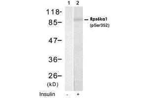 Western blot analysis of extract from HUVEC cells using Rps6ka1 (phospho S352) polyclonal antibody (Cat # PAB12168, Lane 1 and 2). (RPS6KA1 anticorps  (pSer352))