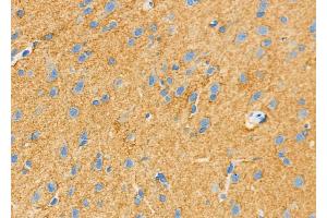 ABIN6262047 and ABIN6279612 at 1/100 staining Rat brain tissue by IHC-P. (GPM6B anticorps  (N-Term))