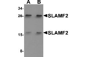 Western blot analysis of SLAMF2 in rat lung tissue lysate with SLAMF2 antibody at (A) 1 and (B) 2 µg/mL. (CD48 anticorps  (Middle Region))