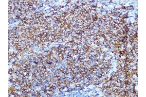 Immunohistochemistry of paraffin-embedded rat spleen using CD79B Rabbit mAb (ABIN1682474, ABIN3018855, ABIN3018856 and ABIN7101674) at dilution of 1:100 (40x lens).