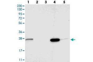 Western blot analysis of Lane 1: RT-4, Lane 2: U-251 MG, Lane 3: Human Plasma, Lane 4: Liver, Lane 5: Tonsil with SIGMAR1 polyclonal antibody .