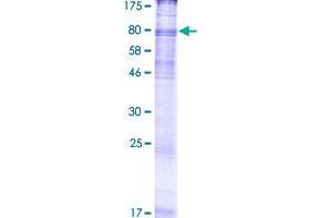 Image no. 1 for Solute Carrier Family 6 (Neurotransmitter Transporter, Creatine), Member 8 (SLC6A8) (AA 1-635) protein (GST tag) (ABIN7540253)