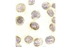 Immunocytochemical staining of DAXX in HeLa cells with DAXX antibody at 10μg/ml. (DAXX anticorps)