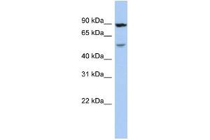 WB Suggested Anti-ALDH6A1 Antibody Titration:  0. (ALDH6A1 anticorps  (Middle Region))