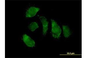 Immunofluorescence of purified MaxPab antibody to EHHADH on HeLa cell. (EHHADH anticorps  (AA 1-723))
