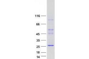 Validation with Western Blot