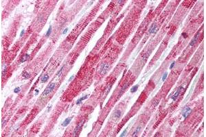 Human Heart (formalin-fixed, paraffin-embedded) stained with TANK antibody ABIN213989 at 2. (TANK anticorps  (N-Term))
