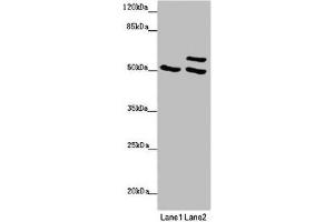 Western blot All lanes: TUBB4A antibody at 2 μg/mL Lane 1: 293T whole cell lysate Lane 2: Hela whole cell lysate Secondary Goat polyclonal to rabbit IgG at 1/10000 dilution Predicted band size: 50 kDa Observed band size: 50, 58 kDa (TUBB4 anticorps  (AA 1-444))