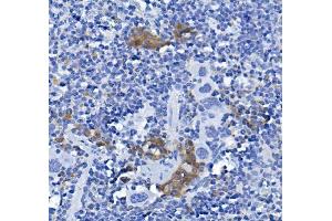 IHC analysis of CD72 using anti-CD72 antibody (ABIN7602483).