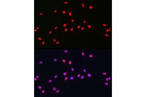 Immunofluorescence analysis of C6 cells using SOX10 Rabbit pAb (ABIN7270568) at dilution of 1:100 (40x lens).