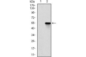 Western Blotting (WB) image for anti-rho-Associated, Coiled-Coil Containing Protein Kinase 1 (ROCK1) antibody (ABIN1846125)