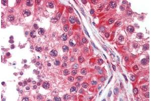 Human Testis (formalin-fixed, paraffin-embedded) stained with DPYSL2 antibody ABIN462302 followed by biotinylated anti-mouse IgG secondary antibody ABIN481714, alkaline phosphatase-streptavidin and chromogen.