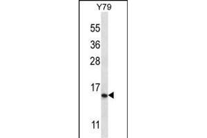 NR2C2 Antibody (N-term) 12673a western blot analysis in Y79 cell line lysates (35 μg/lane). (NR2C2AP anticorps  (N-Term))