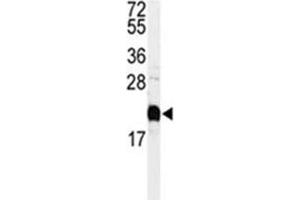 Western blot analysis of Calmodulin antibody and HeLa lysate.