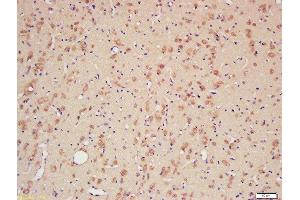 Formalin-fixed and paraffin embedded rat brain labeled with Rabbit Anti-CYPA Polyclonal Antibody, Unconjugated (ABIN759716) at 1:200 followed by conjugation to the secondary antibody and DAB staining