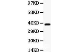 Anti-Hamartin Picoband antibody,  All lanes: Anti Hamartin  at 0. (TSC1 anticorps  (AA 686-884))