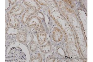 Immunoperoxidase of monoclonal antibody to CLPP on formalin-fixed paraffin-embedded human kidney.