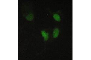 IF analysis of PPCS using anti-PPCS antibody (ABIN6719631). (PPCS anticorps)