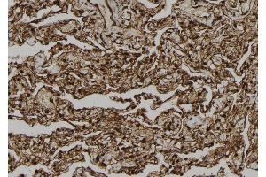 ABIN6278874 at 1/100 staining Human lung tissue by IHC-P. (CARD18 anticorps  (C-Term))