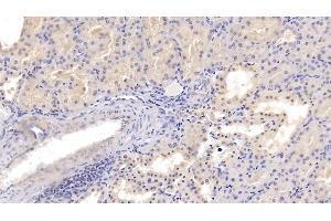 Detection of PDGFB in Porcine Kidney Tissue using Polyclonal Antibody to Platelet Derived Growth Factor Subunit B (PDGFB)