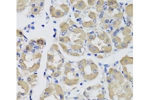 Immunohistochemistry of paraffin-embedded Human stomach using PSPH Polyclonal Antibody at dilution of 1:100 (40x lens).