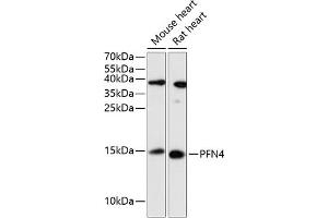 Western blot analysis of extracts of various cell lines, using PFN4 antibody (ABIN6129663, ABIN6145495, ABIN6145496 and ABIN6217780) at 1:3000 dilution.