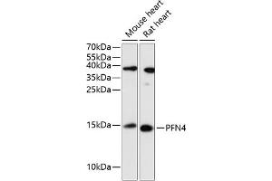 Western blot analysis of extracts of various cell lines, using PFN4 antibody (ABIN6129663, ABIN6145495, ABIN6145496 and ABIN6217780) at 1:3000 dilution. (Profilin 4 anticorps  (AA 1-129))