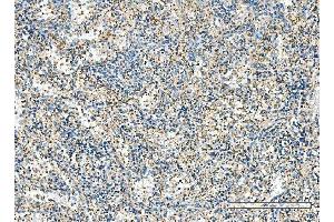 IHC analysis of IMPDH1 using anti-IMPDH1 antibody (ABIN7599864). (IMPDH1 anticorps  (AA 123-500))