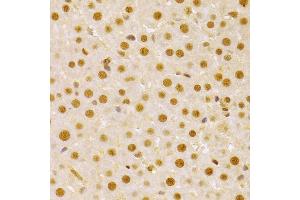 Immunohistochemistry of paraffin-embedded rat liver using CDC25A antibody (ABIN3021625, ABIN3021626, ABIN3021627 and ABIN6215426) at dilution of 1:100 (40x lens).
